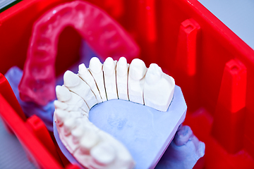 Image showing Gypsum model of human jaw