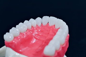 Image showing Upper human jaw with teeth and gums anatomy model