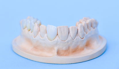 Image showing Gypsum model of human jaw