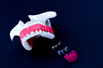 Image showing Tooth implant and crown installation process