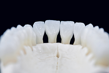 Image showing Lower human jaw with teeth isolated on black background