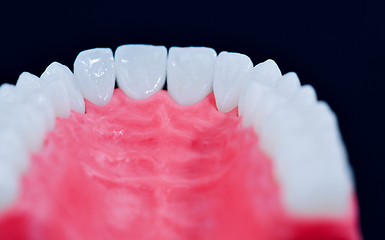 Image showing Upper human jaw with teeth and gums anatomy model