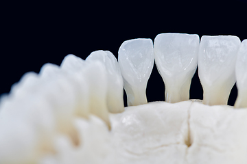 Image showing Lower human jaw with teeth isolated on black background