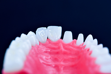 Image showing Tooth implant and crown installation process