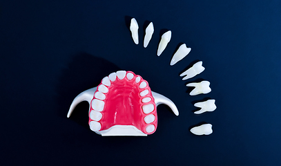 Image showing Tooth implant and crown installation process