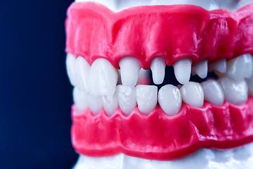 Image showing Human jaw with teeth and gums anatomy model