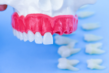 Image showing Tooth implant and crown installation process