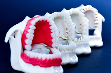 Image showing Dentist orthodontic teeth models