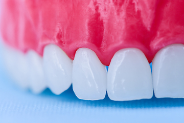 Image showing Upper human jaw with teeth and gums anatomy model