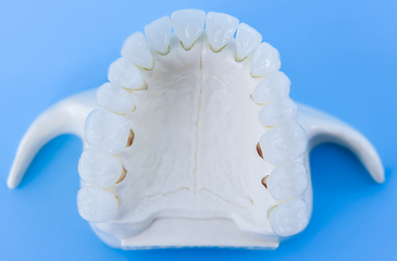 Image showing Upper human jaw with teeth