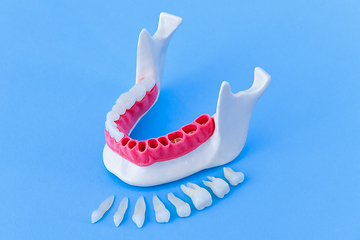 Image showing Tooth implant and crown installation process