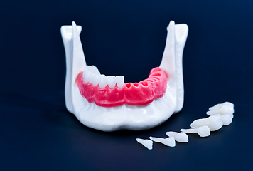 Image showing Tooth implant and crown installation process