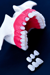 Image showing Tooth implant and crown installation process