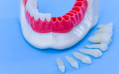 Image showing Tooth implant and crown installation process