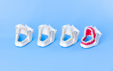 Image showing Dentist orthodontic teeth models