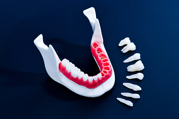 Image showing Tooth implant and crown installation process