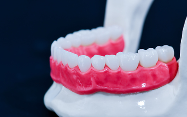 Image showing Lower human jaw with teeth and gums anatomy model