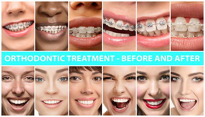 Image showing Beautiful close up portraits, concept of teeth treatment