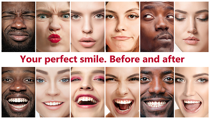 Image showing Beautiful close up portraits, concept of teeth treatment