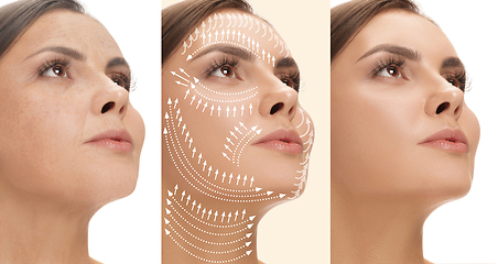 Image showing Beautiful female face, concept of skincare and lifting