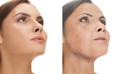 Image showing Beautiful female face, concept of skincare and lifting