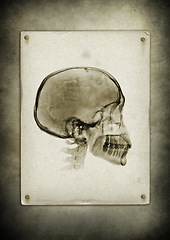 Image showing X-ray skull on a vintage paper background