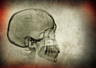 Image showing X-ray skull on a dark textured background