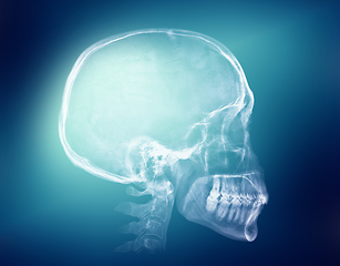 Image showing Human skull X-ray image