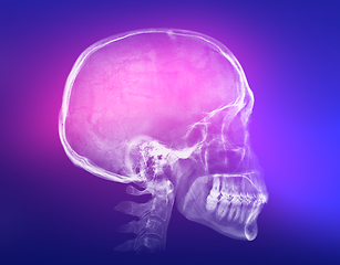 Image showing Human skull X-ray image