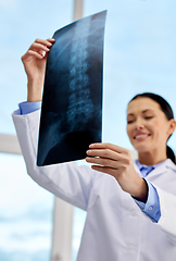 Image showing happy female doctor with x-ray at hospital