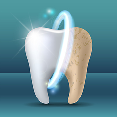 Image showing Clean and dirty tooth before and after whitening