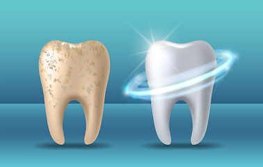 Image showing Clean and dirty tooth before and after whitening