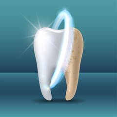 Image showing Clean and dirty tooth before and after whitening