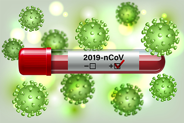 Image showing Test tube with blood sample for COVID-19, Coronavirus test.