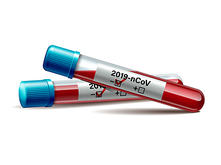 Image showing Test tube with blood sample for COVID-19, Coronavirus test.