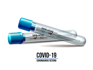 Image showing Test tubes with cotton swab for nasopharyngeal specimens.