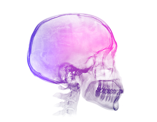 Image showing Human skull X-ray image