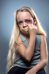 Image showing Sad and frightened little girl with bloodshot and bruised eyes, fiction of happiness