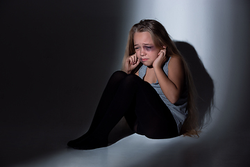 Image showing Sad and frightened little girl with bloodshot and bruised eyes sitting scared