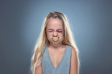 Image showing Sad and frightened little girl with bloodshot and bruised eyes, fiction of happiness