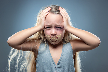 Image showing Sad and frightened little girl with bloodshot and bruised eyes, fiction of happiness