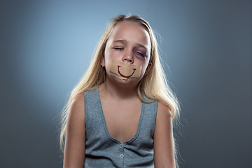 Image showing Sad and frightened little girl with bloodshot and bruised eyes, fiction of happiness