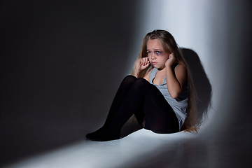 Image showing Sad and frightened little girl with bloodshot and bruised eyes sitting scared