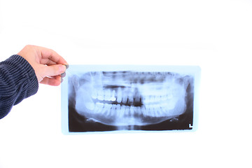 Image showing dental photo