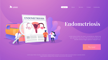 Image showing Endometriosis landing page concept