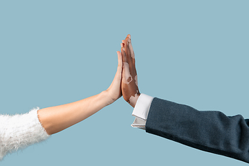 Image showing Close up of male hands with vitiligo pigments isolated on blue studio background