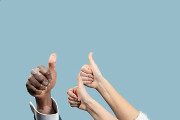 Image showing Close up of male and female hands with vitiligo pigments isolated on blue studio background