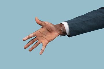 Image showing Close up of male hands with vitiligo pigments isolated on blue studio background