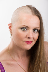 Image showing beautiful woman cancer patient