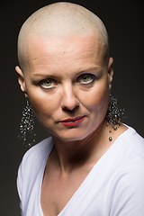 Image showing beautiful woman cancer patient without hair